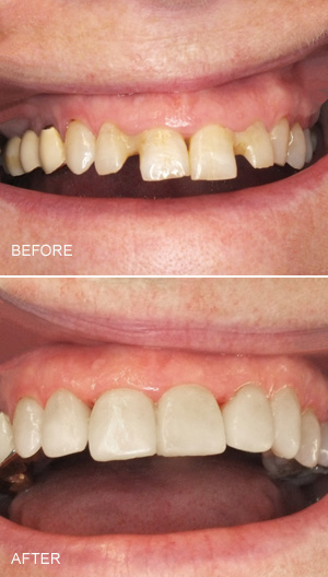 cosmetic dentistry